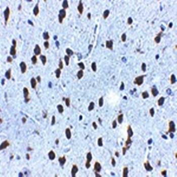 SCF Rabbit Polyclonal Antibody