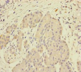 SCFD1 Antibody