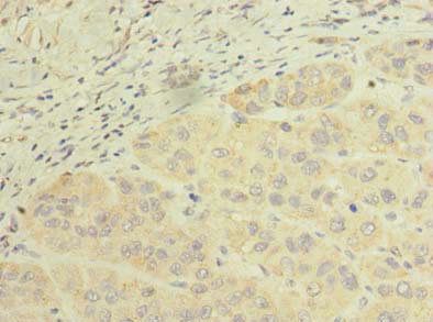 SCFD2 Antibody