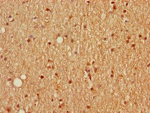 SCGN Antibody