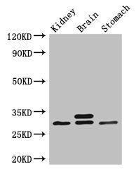 SCGN antibody