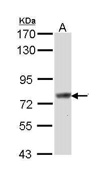 SCIN antibody [N3C2], Internal