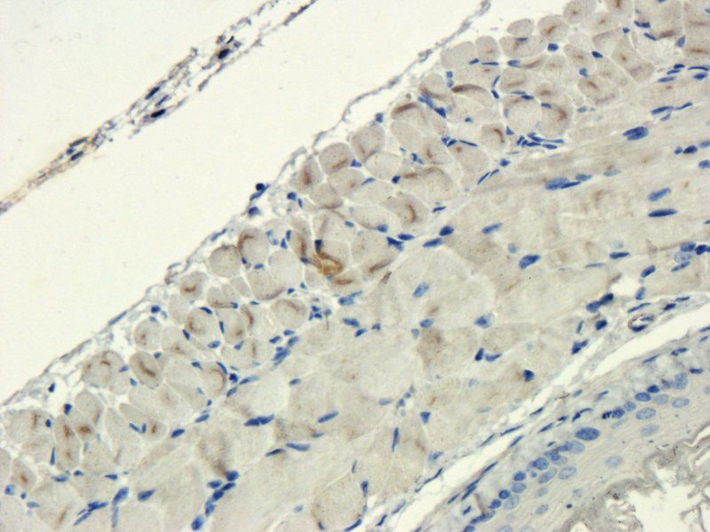 Sclerostin antibody