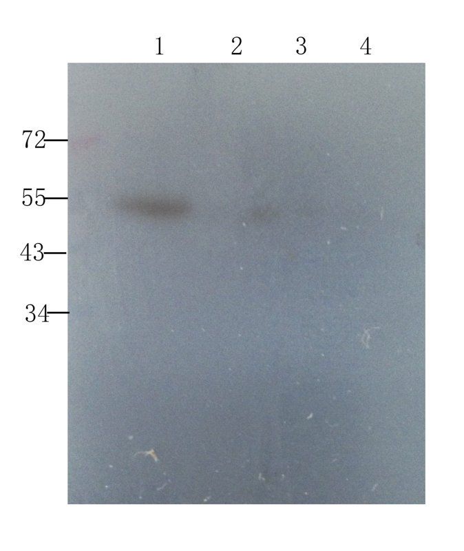 Sclerostin antibody