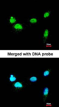 SCMH1 antibody