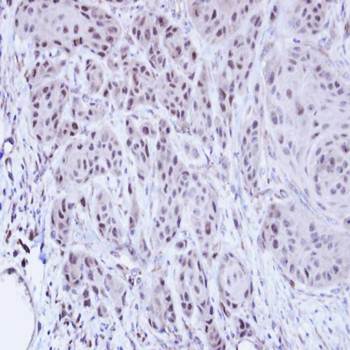 SCMH1 antibody