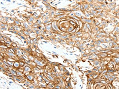 SCN10A Antibody