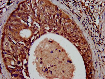 SCN11A antibody