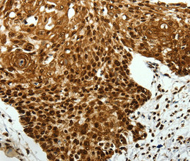 SCN11A antibody