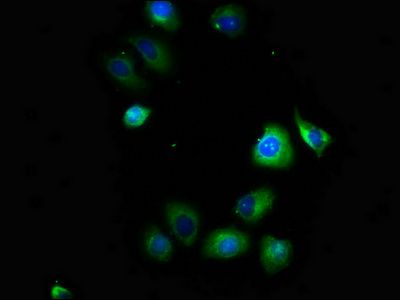 SCN1B antibody