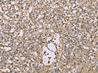 SCN1B Antibody