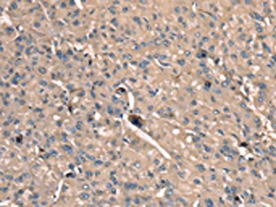 SCN1B Antibody