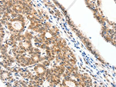 SCN2A Antibody