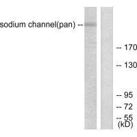 SCN5A antibody