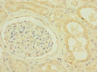 SCN7A Antibody