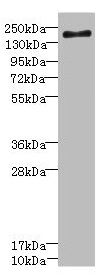 SCN7A antibody