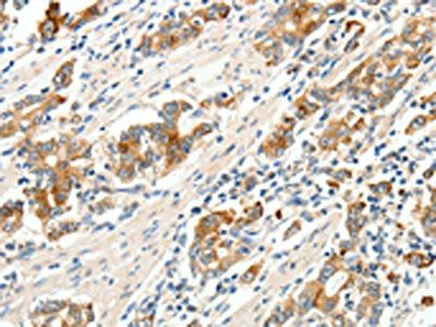 SCN9A Antibody