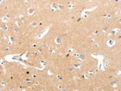 SCN9A Antibody