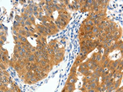 SCN9A Antibody