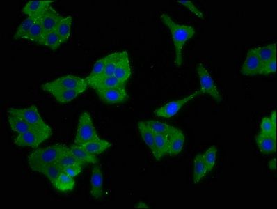SCNN1B Antibody