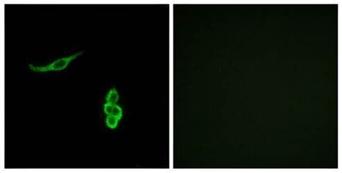 SCNN1D Antibody