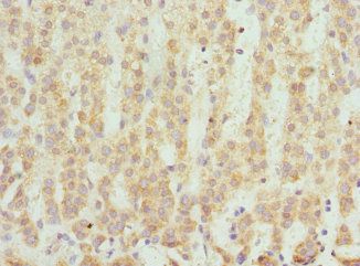 SCO2 antibody