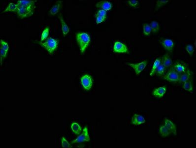 SCOC antibody