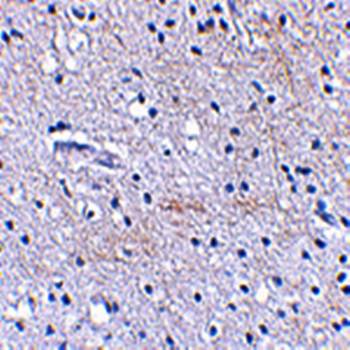 SCRAPPER Antibody