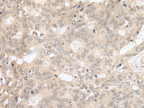 HOXA2 Antibody