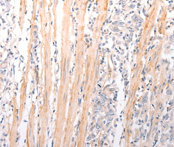 ABCA2 Antibody