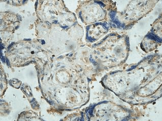 C11orf42 Rabbit Polyclonal Antibody