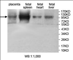 Anti-JHDM1D Antibody