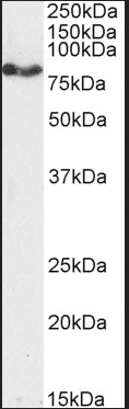 Goat anti-CPT1A Antibody
