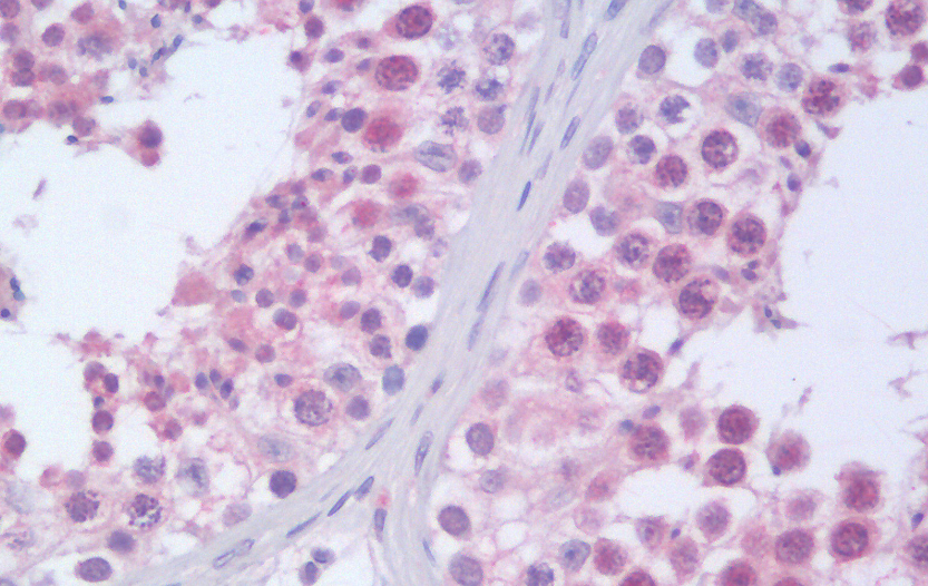 Goat anti-RANBPM / RANBP9 Antibody