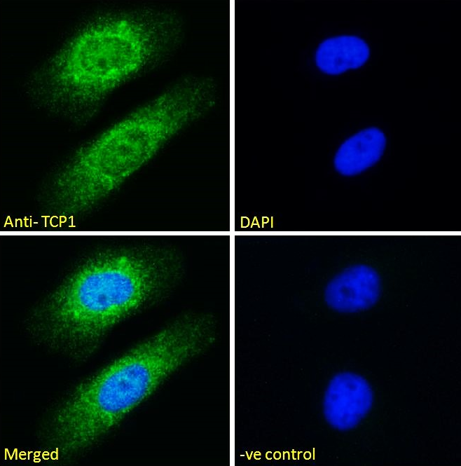 Goat anti-TCP1 Antibody
