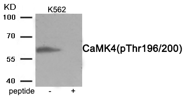 CaMK4 (Phospho-Thr196/200) Antibody