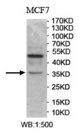 C11orf42 Rabbit Polyclonal Antibody