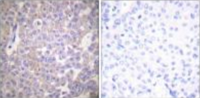 Claudin 2 Antibody