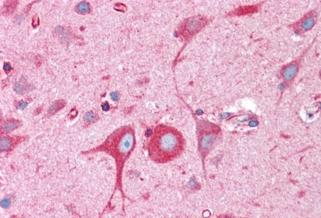 Goat anti-BCAP31 / BAP31 Antibody