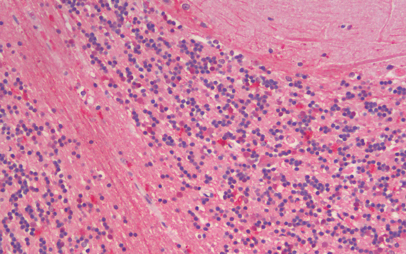 Goat anti-ZNRF1 (mouse) Antibody