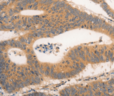 CSF3R Antibody