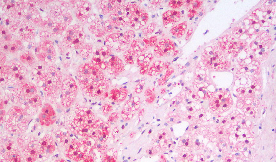 Goat anti-MSI2 / musashi-2 (aa33-43) Antibody