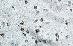 JHDM1D Rabbit Polyclonal Antibody