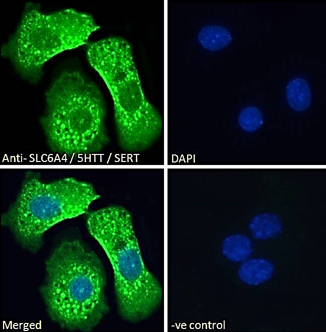 Goat anti-SLC6A4 / 5HTT / SERT Antibody