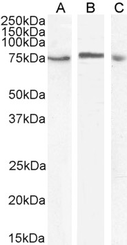 MAP3K7 antibody