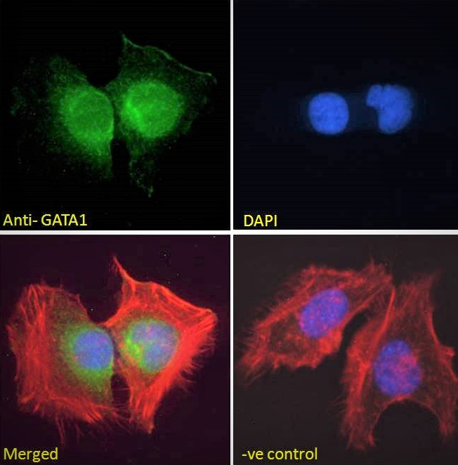 GATA1 antibody