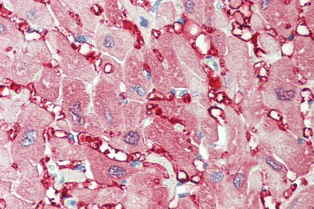 Goat anti-creatine kinase M-type Antibody