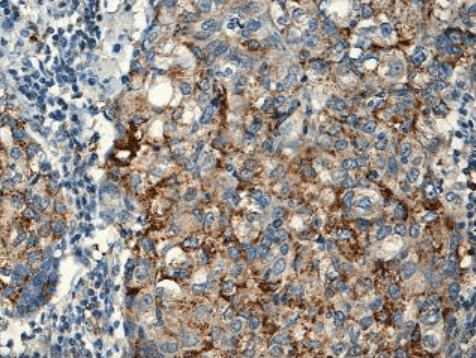 BEND5 Rabbit Polyclonal Antibody