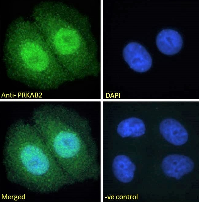 Goat anti-PRKAB2 Antibody