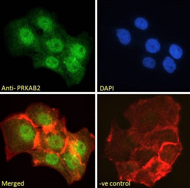 PRKAB2 antibody